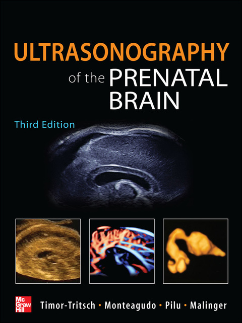 Cover image for book Ultrasonography of the Prenatal Brain, Third Edition