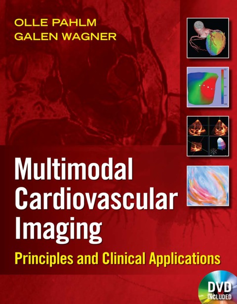 Cover image for book Multimodal Cardiovascular Imaging