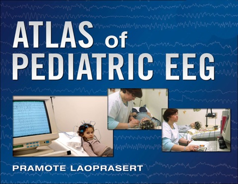 Cover image for book Atlas of Pediatric EEG