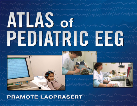 Cover image for book Atlas of Pediatric EEG