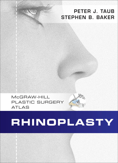 Cover image for book Rhinoplasty