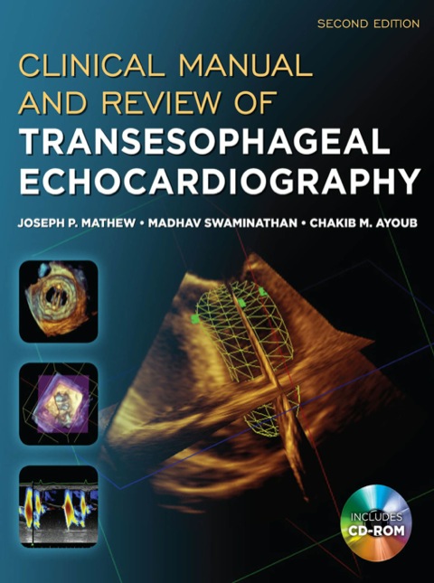 Cover image for book Clinical Manual and Review of Transesophageal Echocardiography
