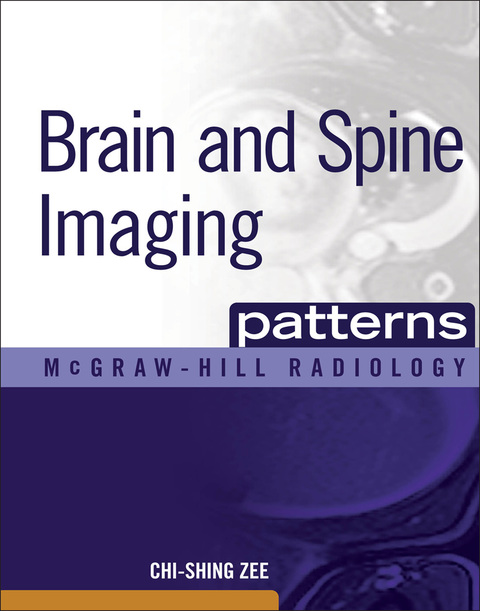 Cover image for book Brain and Spine Imaging Patterns