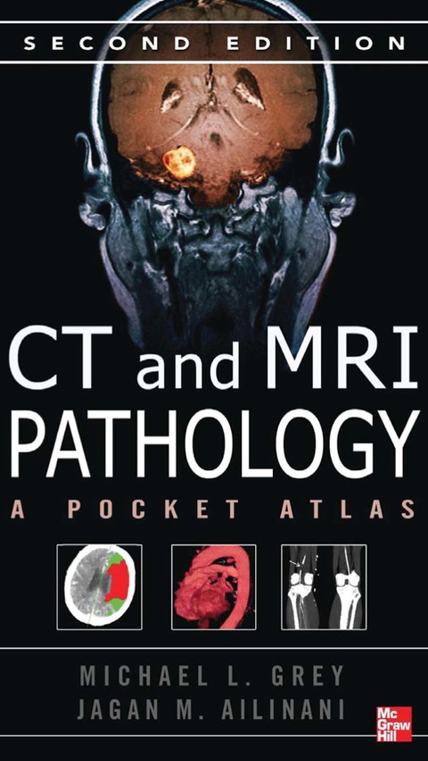 Cover image for book CT & MRI Pathology: A Pocket Atlas, Second Edition