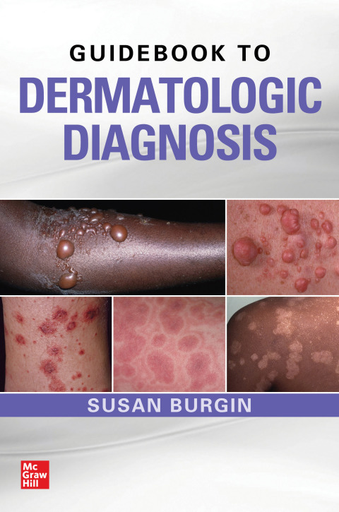 Cover image for book Guidebook to Dermatologic Diagnosis