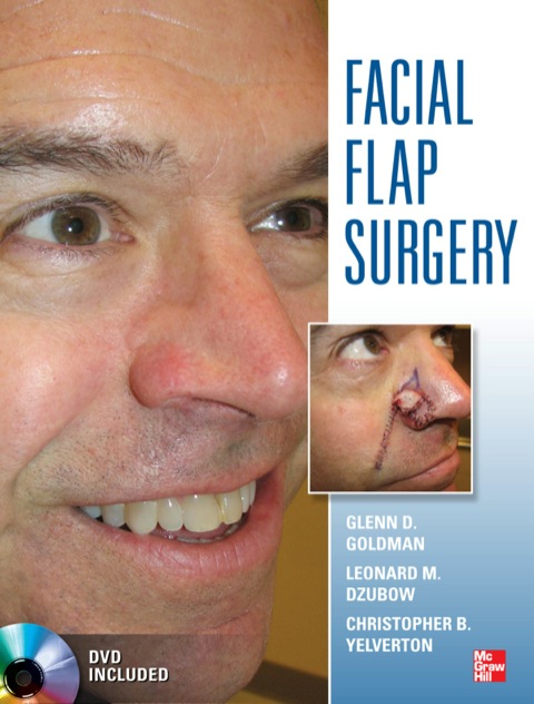 Cover image for book Facial Flaps Surgery