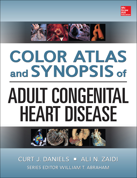 Cover image for book Color Atlas and Synopsis of Adult Congenital Heart Disease
