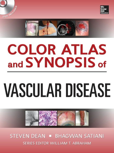 Cover image for book Color Atlas and Synopsis of Vascular Disease
