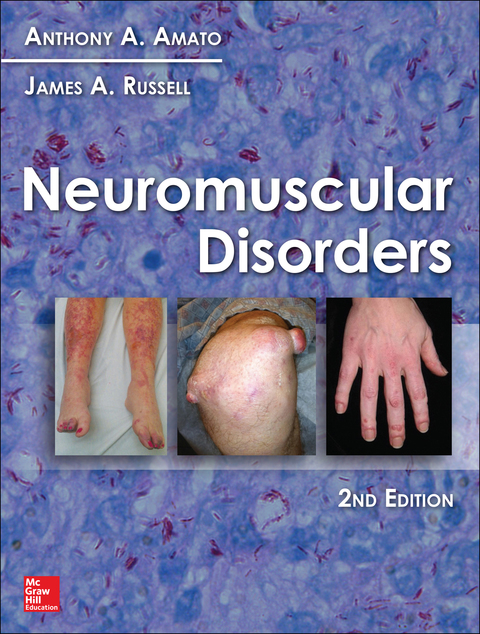 Cover image for book Neuromuscular Disorders, 2nd Edition