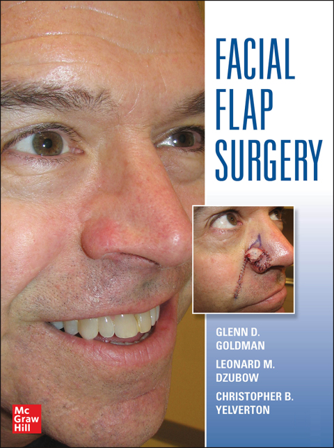Cover image for book Facial Flaps Surgery