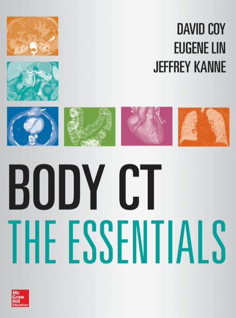 Cover image for book Body CT The Essentials