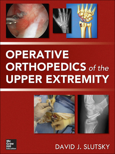 Cover image for book Operative Orthopedics of the Upper Extremity