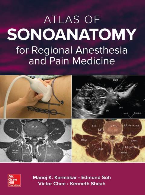 Cover image for book Atlas of Sonoanatomy for Regional Anesthesia and Pain Medicine