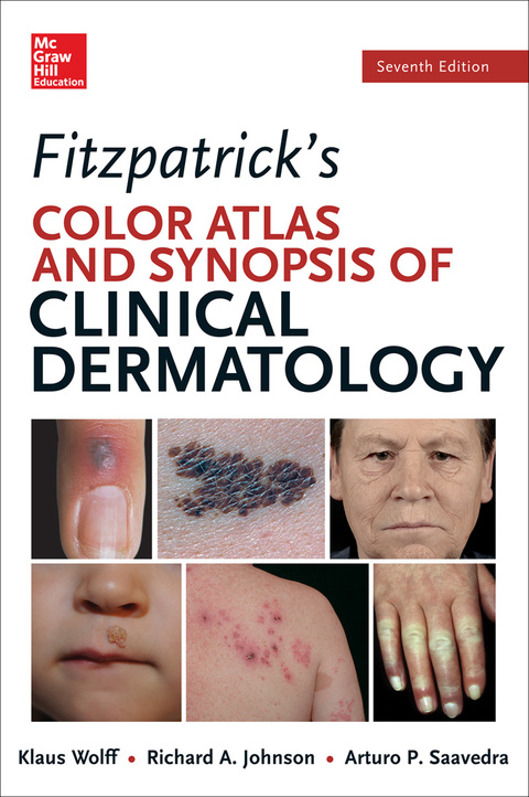 Cover image for book Fitzpatrick's Color Atlas and Synopsis of Clinical Dermatology