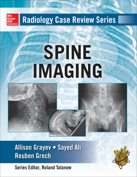 Cover image for book Radiology Case Review Series: Spine