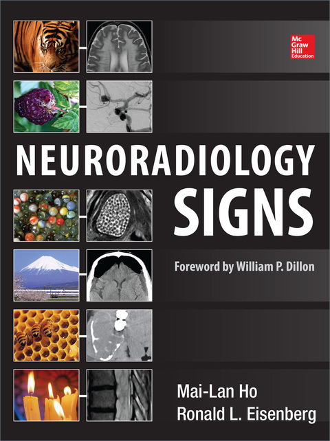 Cover image for book Neuroradiology Signs
