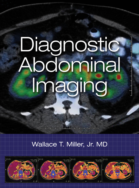 Cover image for book Diagnostic Abdominal Imaging