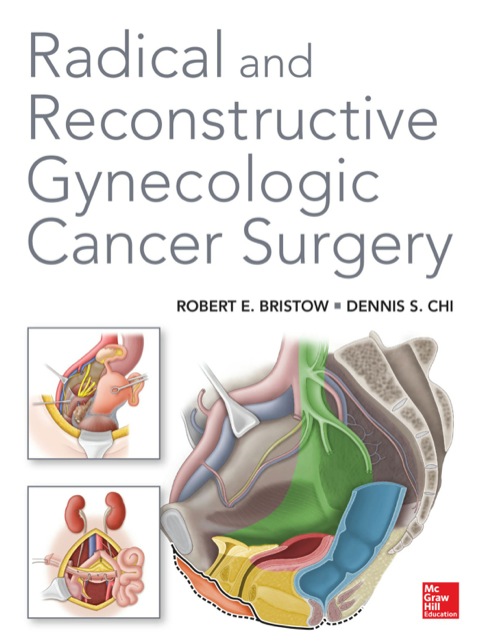 Cover image for book Radical and Reconstructive Gynecologic Cancer Surgery