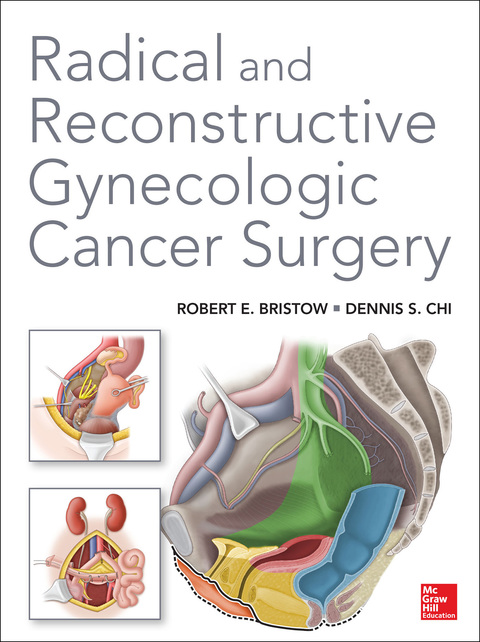Cover image for book Radical and Reconstructive Gynecologic Cancer Surgery