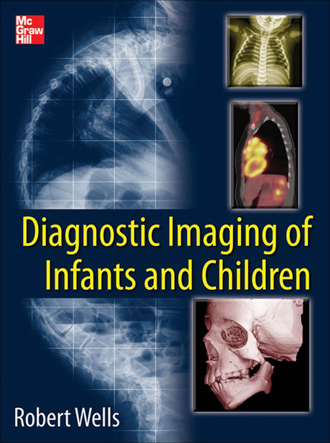 Cover image for book Diagnostic Imaging of Infants and Children