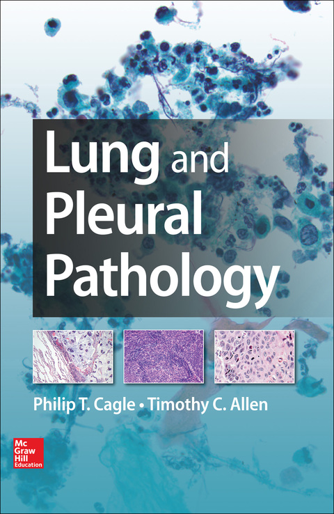 Cover image for book Lung and Pleural Pathology