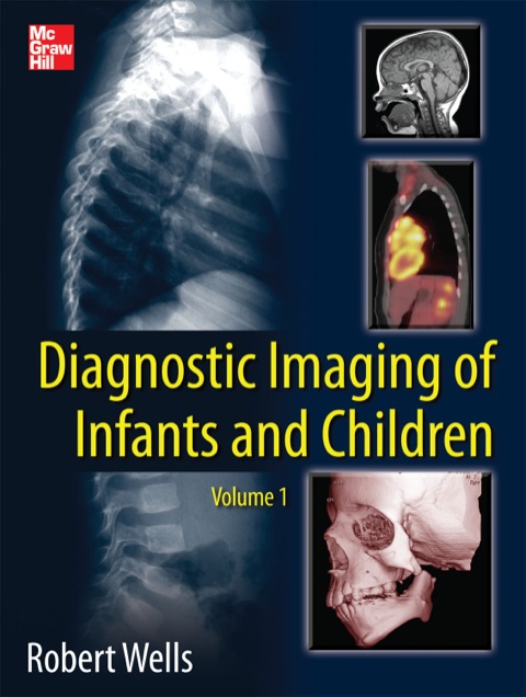 Cover image for book Diagnostic Imaging of Infants and Children