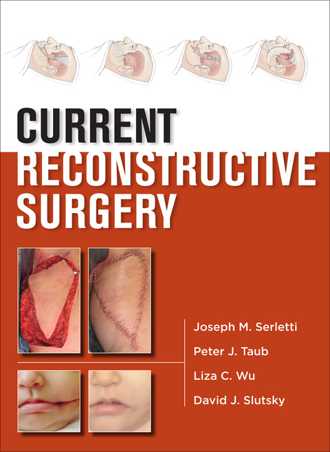 Cover image for book Current Reconstructive Surgery