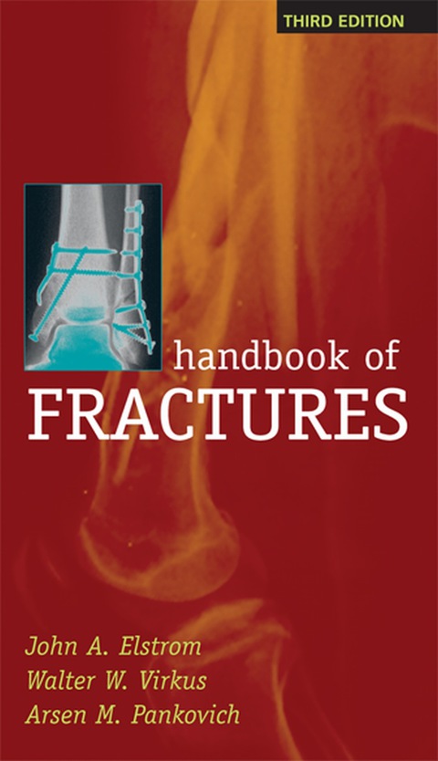 Cover image for book Handbook of Fractures, Third Edition