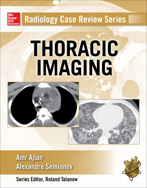 Cover image for book Radiology Case Review Series: Thoracic Imaging