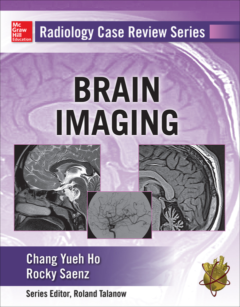 Cover image for book Radiology Case Review Series: Brain Imaging