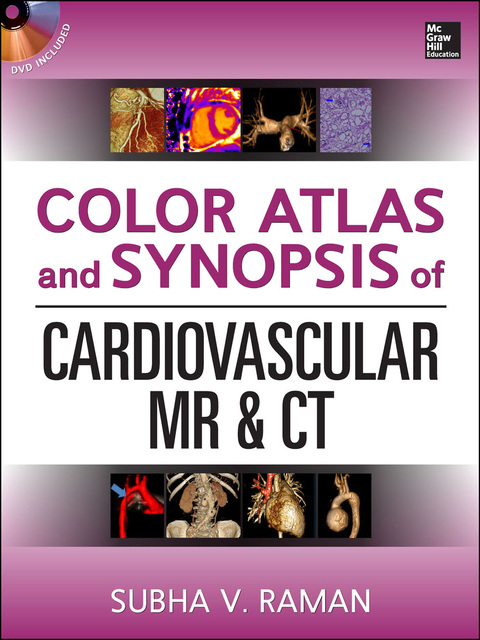 Cover image for book Color Atlas and Synopsis of Cardiovascular MR and CT (SET 2)
