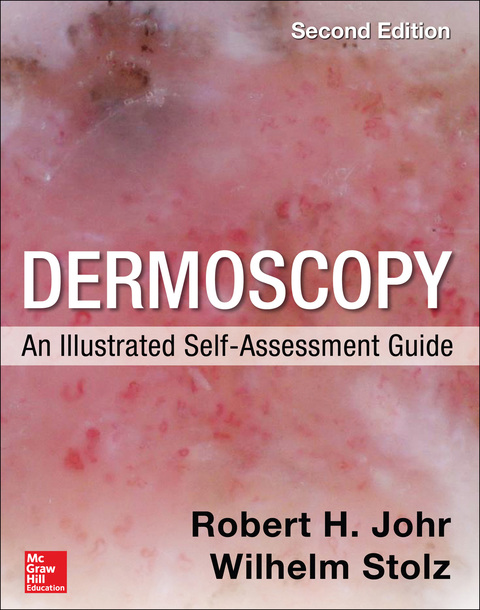 Cover image for book Dermoscopy: An Illustrated Self-Assessment Guide