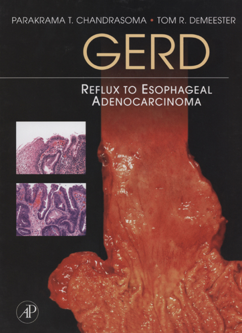 Cover image for book GERD