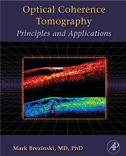 Cover image for book Optical Coherence Tomography