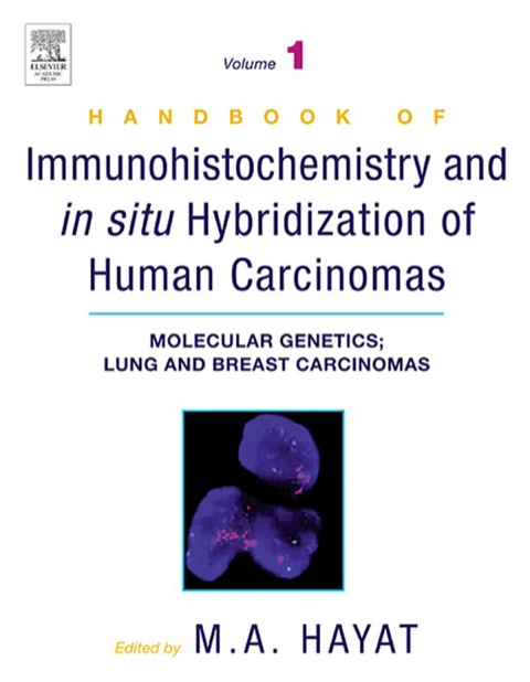 Cover image for book Handbook of Immunohistochemistry and in Situ Hybridization of Human Carcinomas