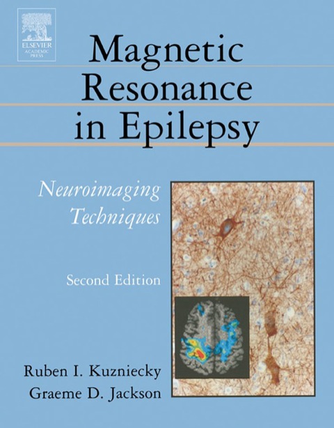 Cover image for book Magnetic Resonance in Epilepsy