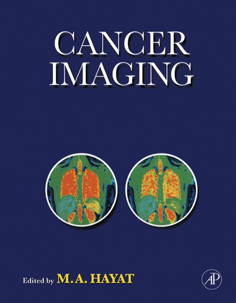 Cover image for book Cancer Imaging