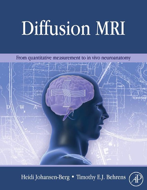 Cover image for book Diffusion MRI