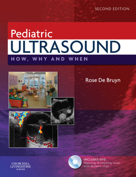 Cover image for book Pediatric Ultrasound