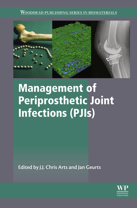 Cover image for book Management of Periprosthetic Joint Infections (PJIs)
