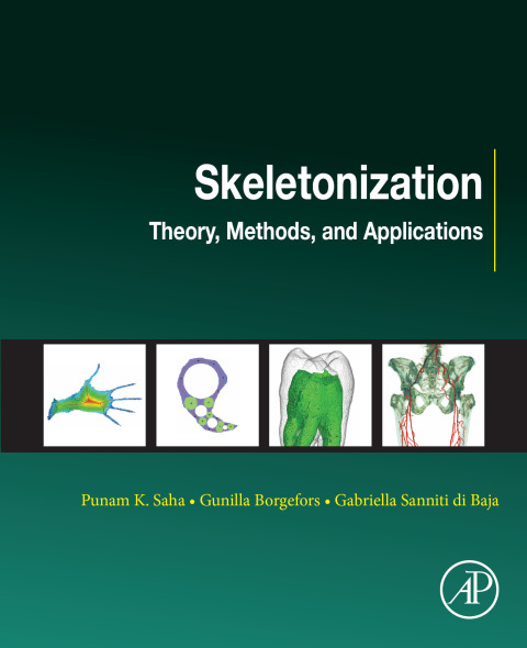 Cover image for book Skeletonization
