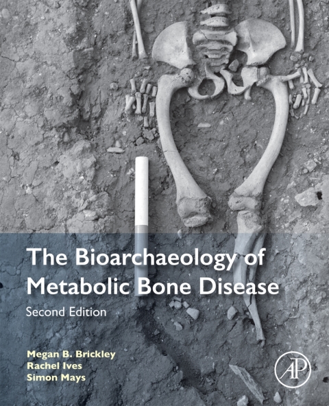 Cover image for book The Bioarchaeology of Metabolic Bone Disease
