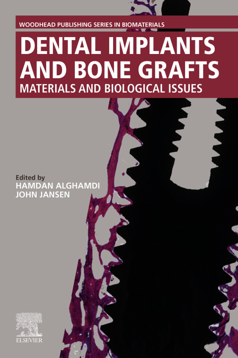 Cover image for book Dental Implants and Bone Grafts
