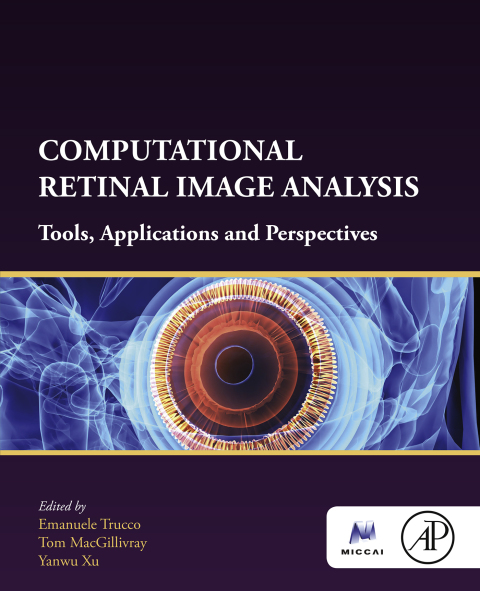 Cover image for book Computational Retinal Image Analysis