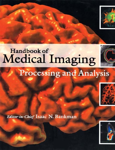 Cover image for book Handbook of Medical Imaging: Processing and Analysis Management