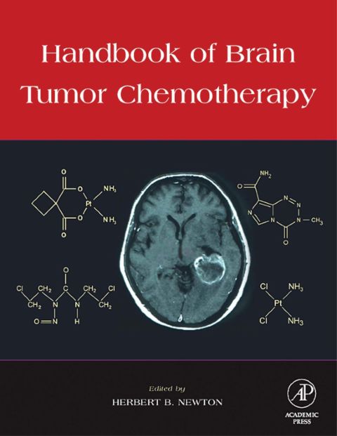 Cover image for book Handbook of Brain Tumor Chemotherapy