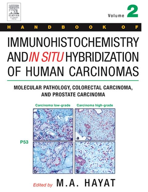 [1825 days] Handbook of Immunohistochemistry and in Situ Hybridization of Human Carcinomas: Molecular Pathology, Colorectal Carcinoma, and Prostate Carcinoma