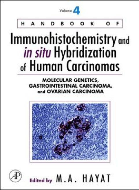 Cover image for book Handbook of Immunohistochemistry and in situ Hybridization of Human Carcinomas: Molecular Genetics, Gastrointestinal Carcinoma, and Ovarian Carcinoma
