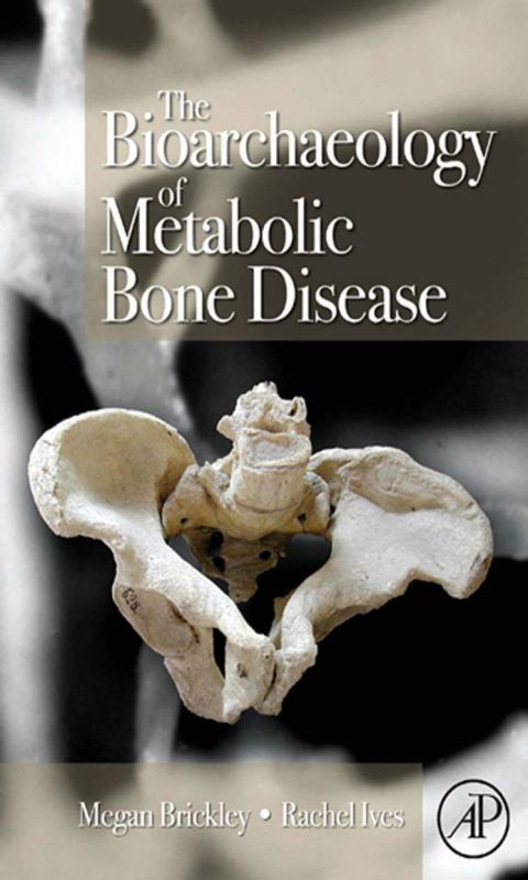 [1825 days] The Bioarchaeology of Metabolic Bone Disease