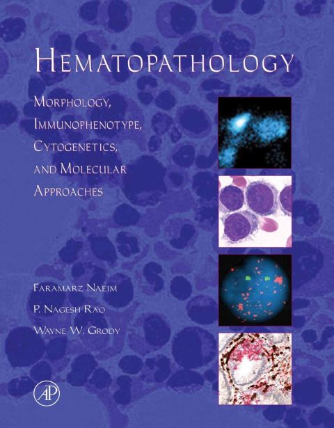 Cover image for book Hematopathology: Morphology, Immunophenotype, Cytogenetics, and Molecular Approaches